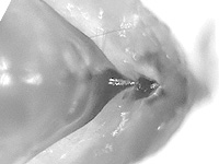 Thaumantis diores diores ♂ genitalia