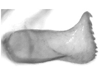 Orthomiella fukienensis diversa ♂ genitalia