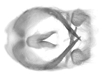 Tajuria culta dayi ♂ genitalia