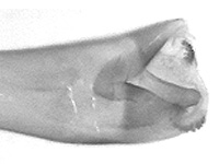 Rapala rectivitta ♂ genitalia Rapala rectivitta ♂ genitalia