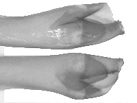 Rapala rosacea ♂ genitalia