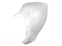 Pontia edusa amphimara ♂genitalia
