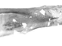Euploea orontobates ♂ genitalia