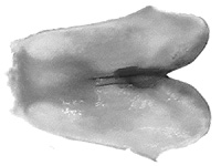 Euploea orontobates ♂ genitalia