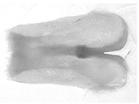 Euploea core graminifera ♂ genitalia