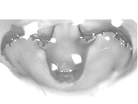 Enispe duranius intermedia ♀ genitalia Enispe duranius intermedia ♀ genitalia