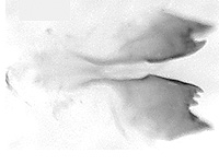 Euthalia saitaphernes saitaphernes ♂ genitalia